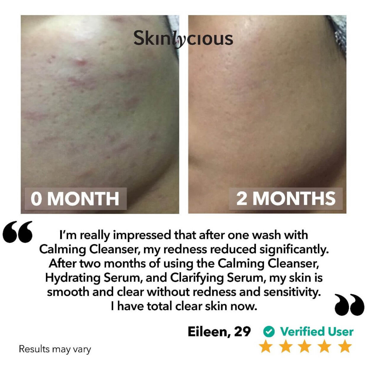 Calming Cleanser