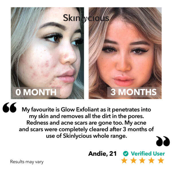 Andie - Glow Exfoliant