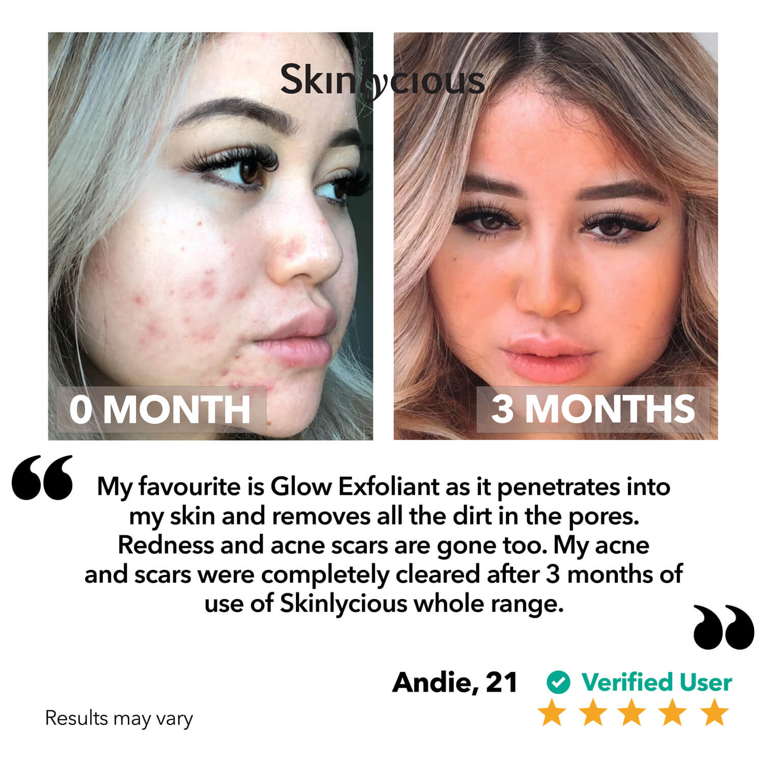 Glow Exfoliant