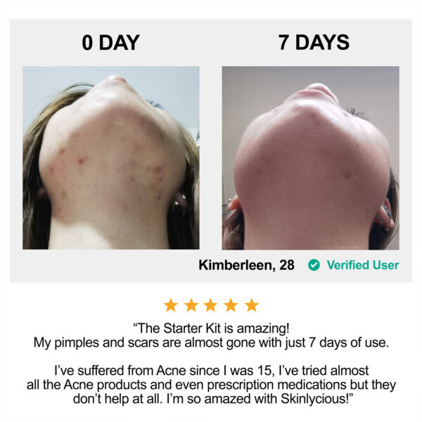 Kim's Before-After Review