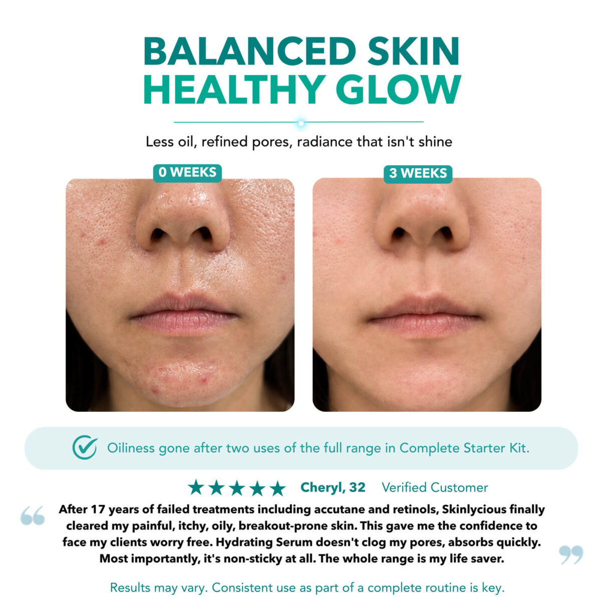 Oily skin before and after three weeks using a Skinlycious skincare routine