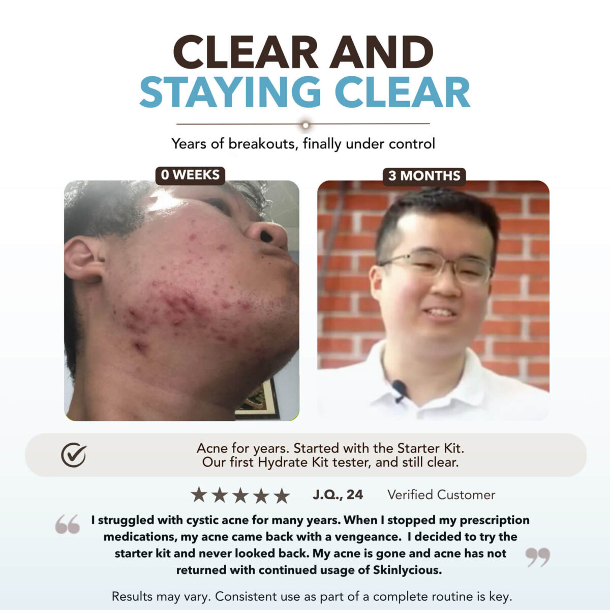 Skinlycious customer before-and-after photos showing changes in the appearance of acne-prone skin after three months