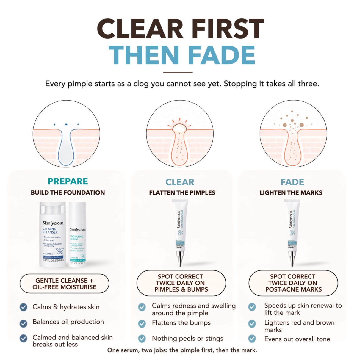 Skinlycious Hydrate Kit compared with typical acne kits, highlighting gentle cleansing and skin barrier hydration