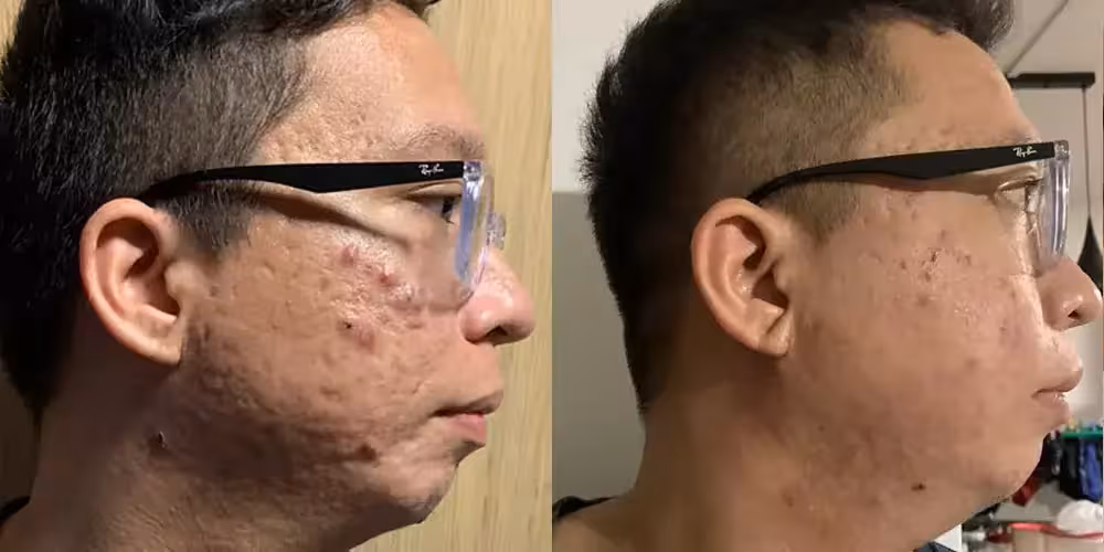 Skinlycious result 04