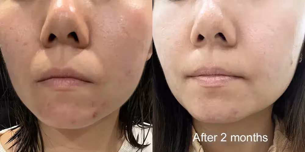 Skinlycious result 10