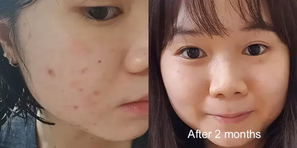 Skinlycious result 01