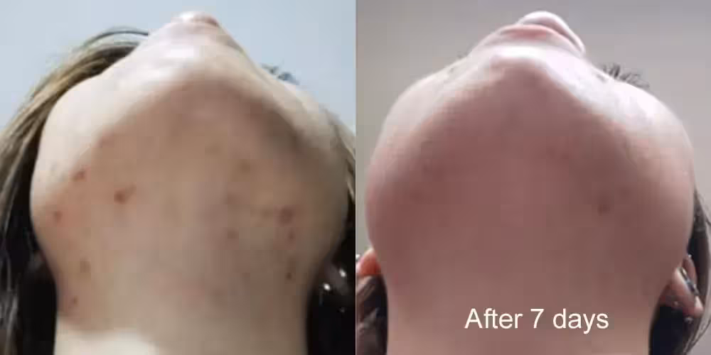 Skinlycious result 01