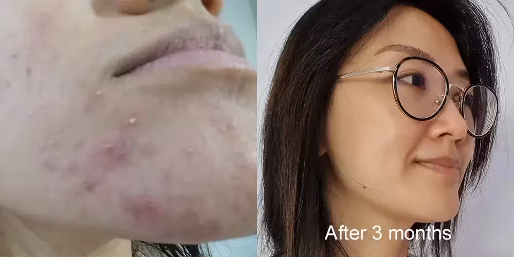 Skinlycious result 03