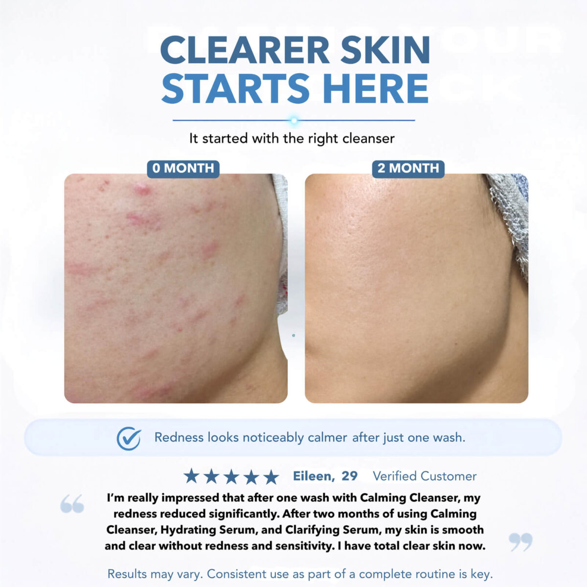 Skin before and after two months of a Skinlycious routine showing visibly calmer and clearer-looking skin