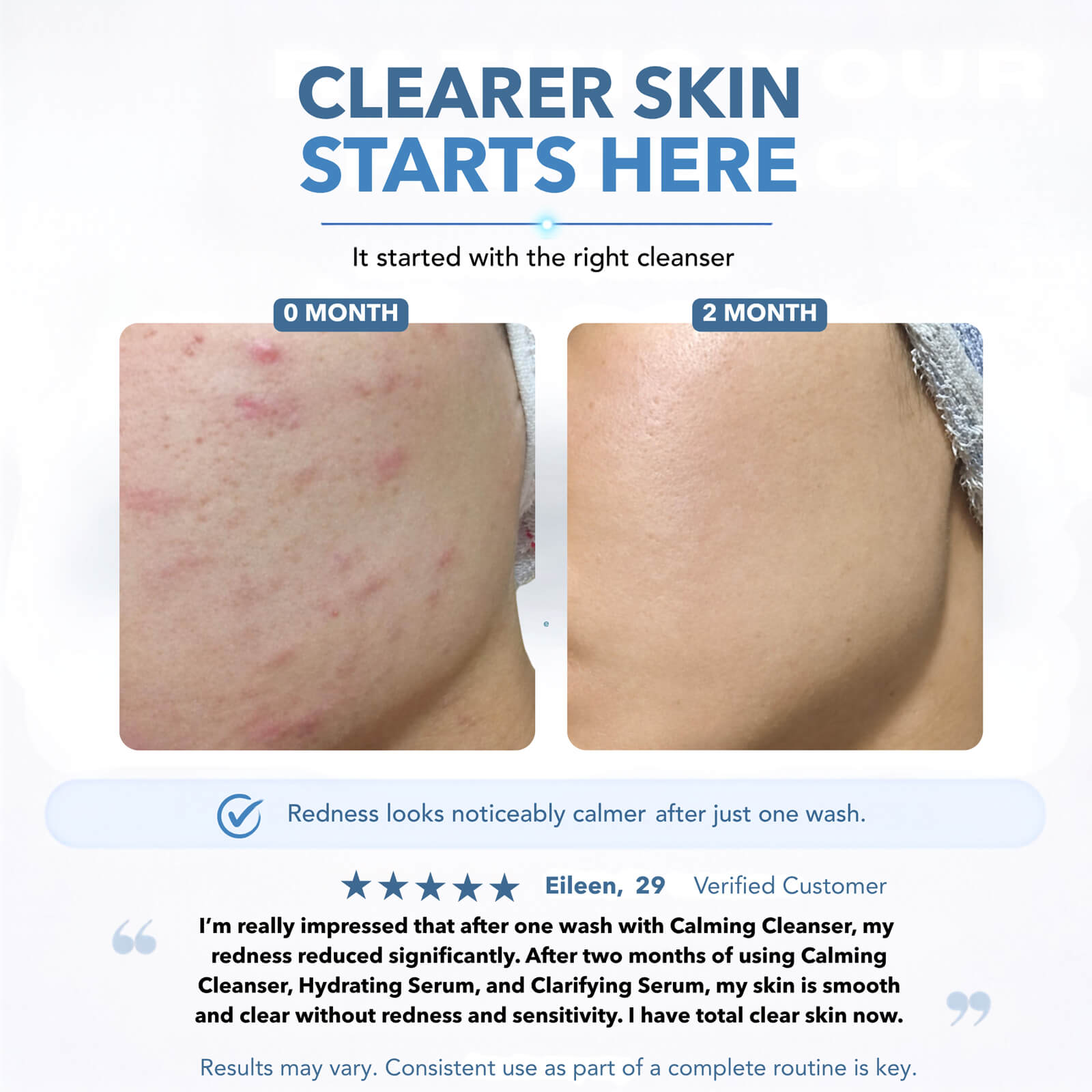 Skin before and after two months of a Skinlycious routine showing visibly calmer and clearer-looking skin