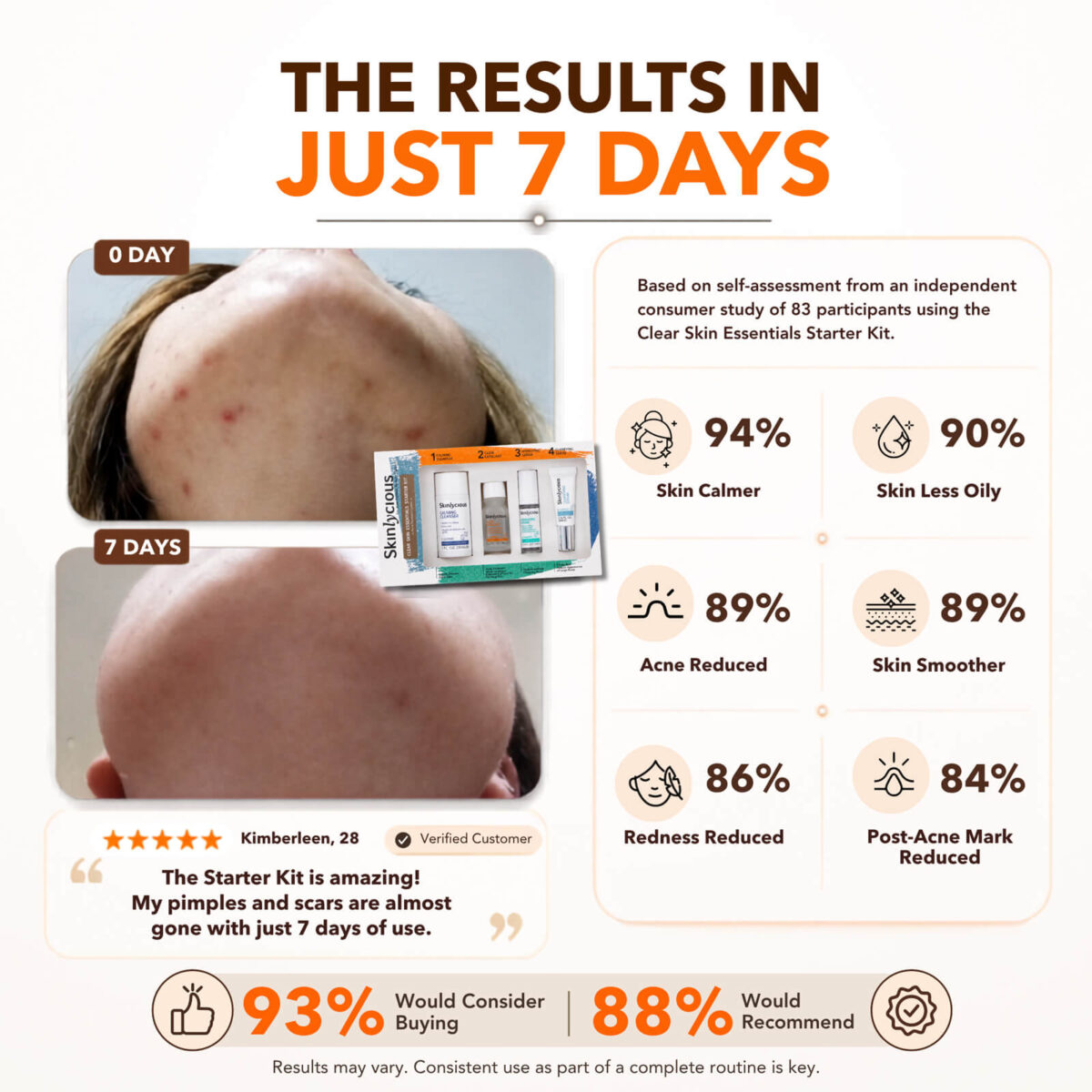 Clear Skin Essentials Starter Kit 7-day results showing reduced acne, oiliness, redness and post-acne marks