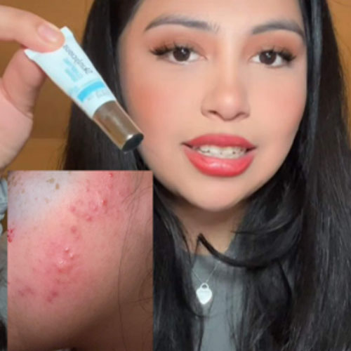 The teenager who keeps breaking out