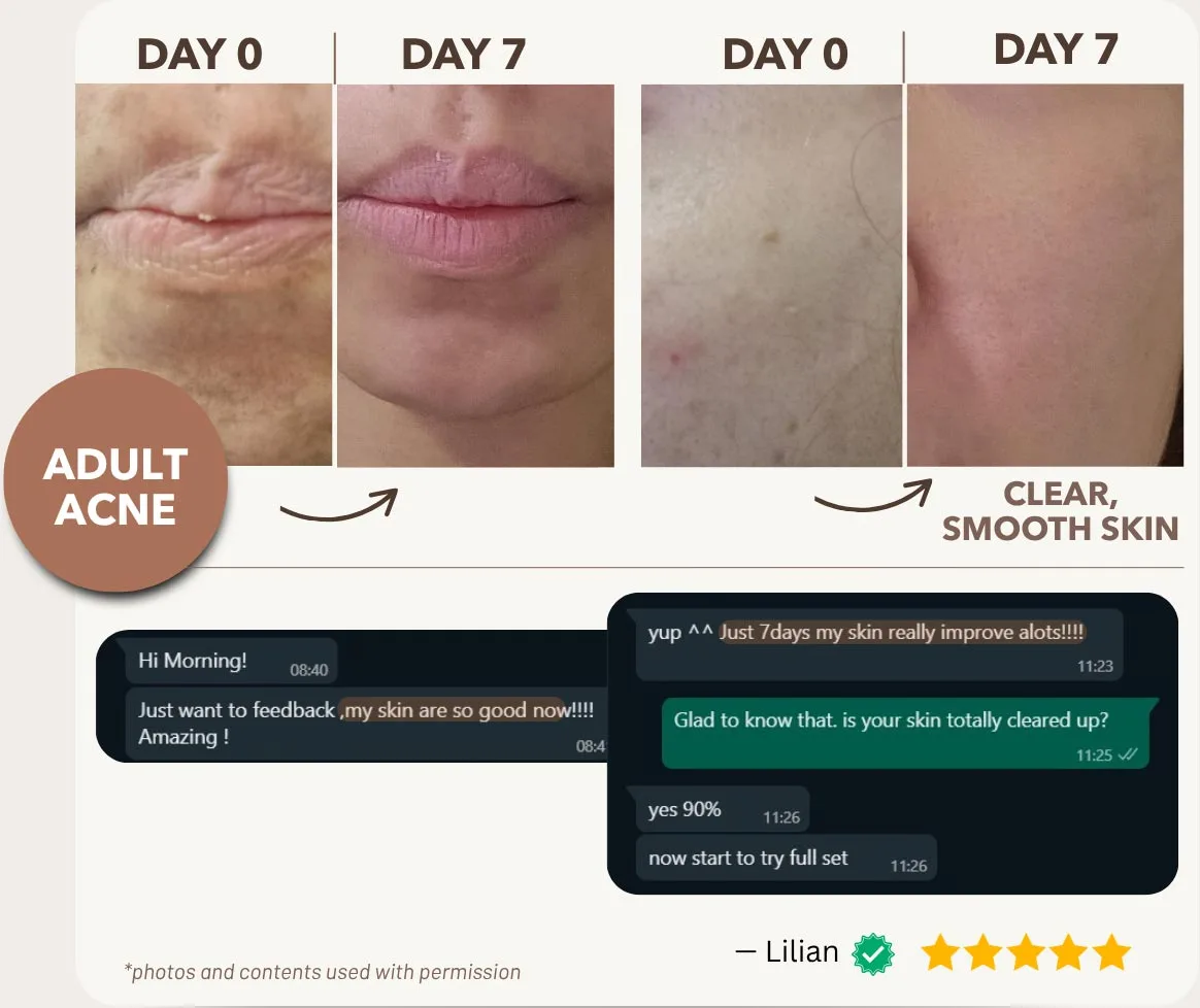 Addresses Problem Skin at the Root — So Skin Stays Clear, Smooth, and Glowing