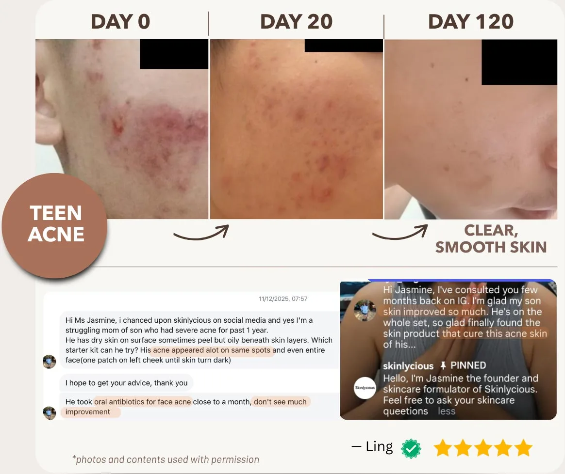 Addresses Problem Skin at the Root — So Skin Stays Clear, Smooth, and Glowing