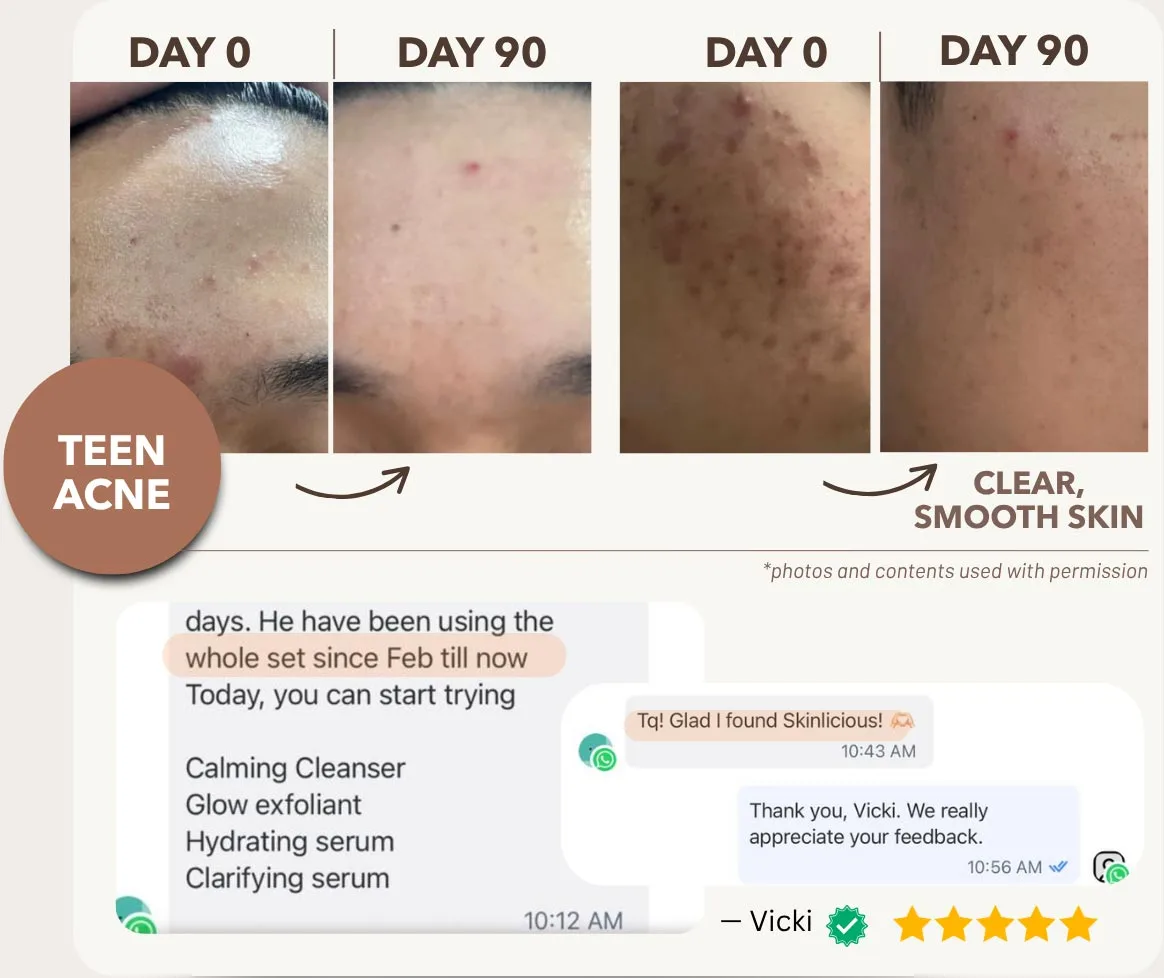 Addresses Problem Skin at the Root — So Skin Stays Clear, Smooth, and Glowing
