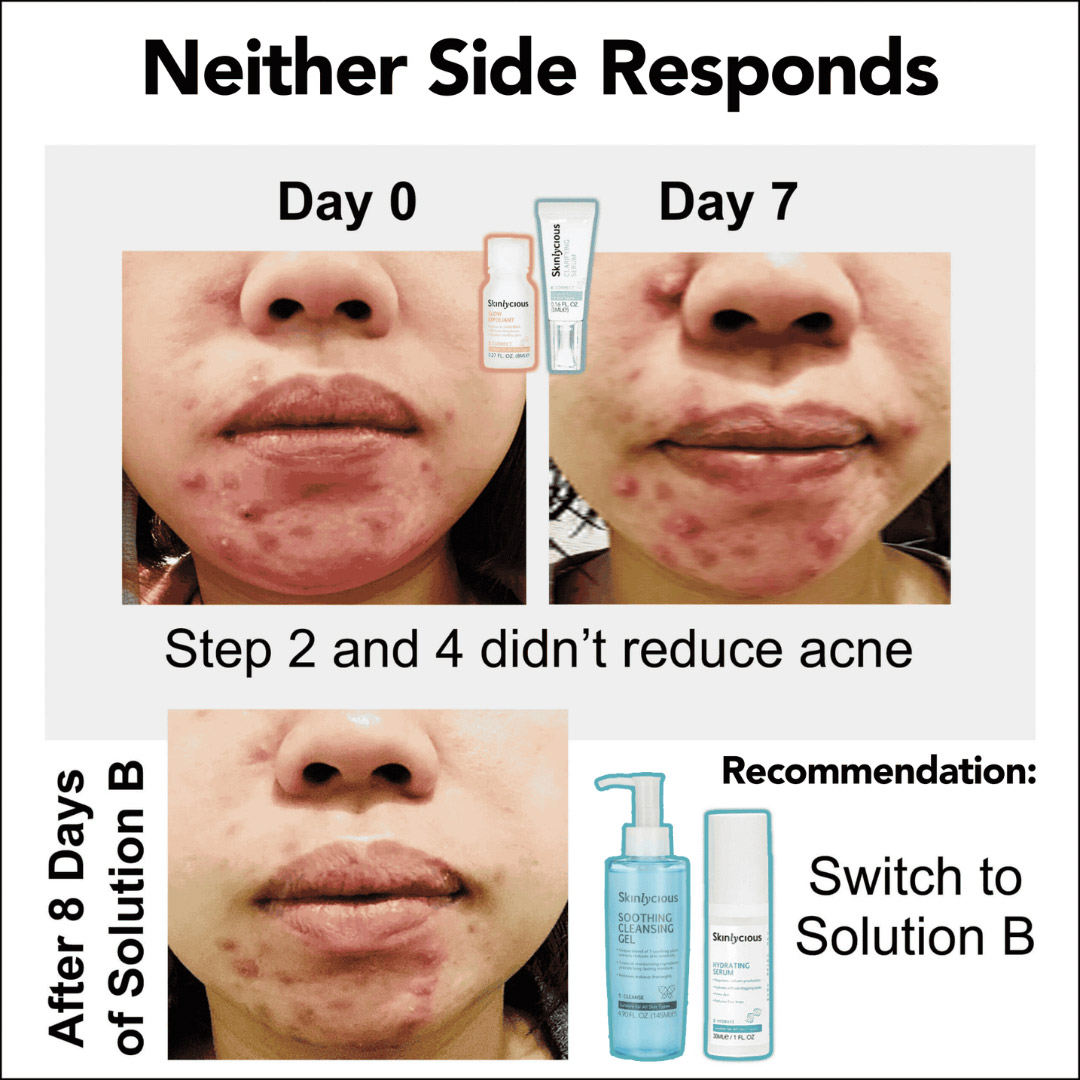 2 Proven Paths to Clear Skin 05