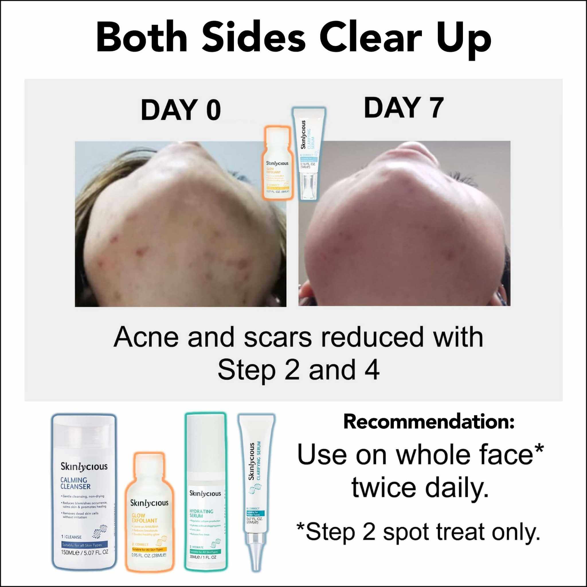 2 Proven Paths to Clear Skin 04