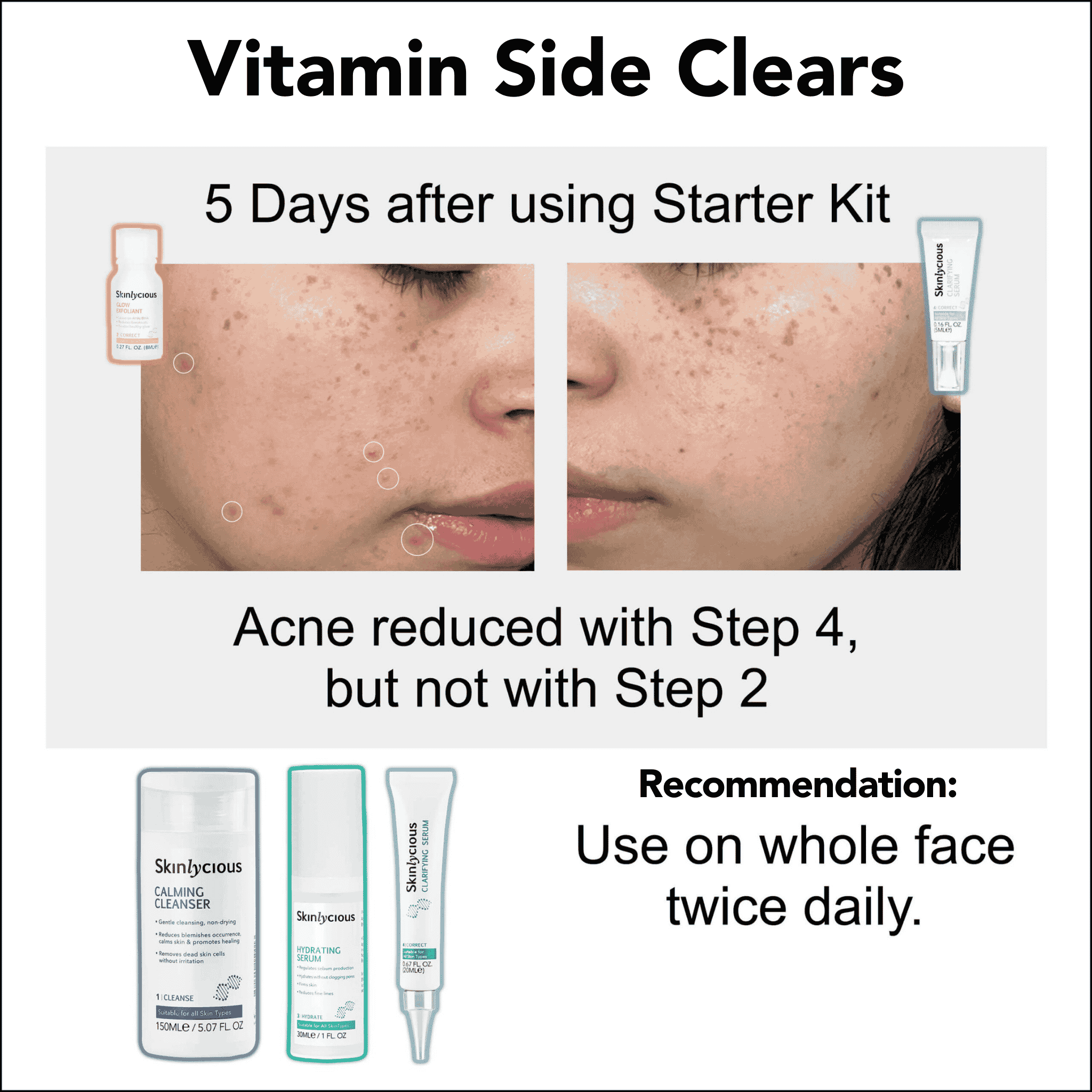 2 Proven Paths to Clear Skin 04