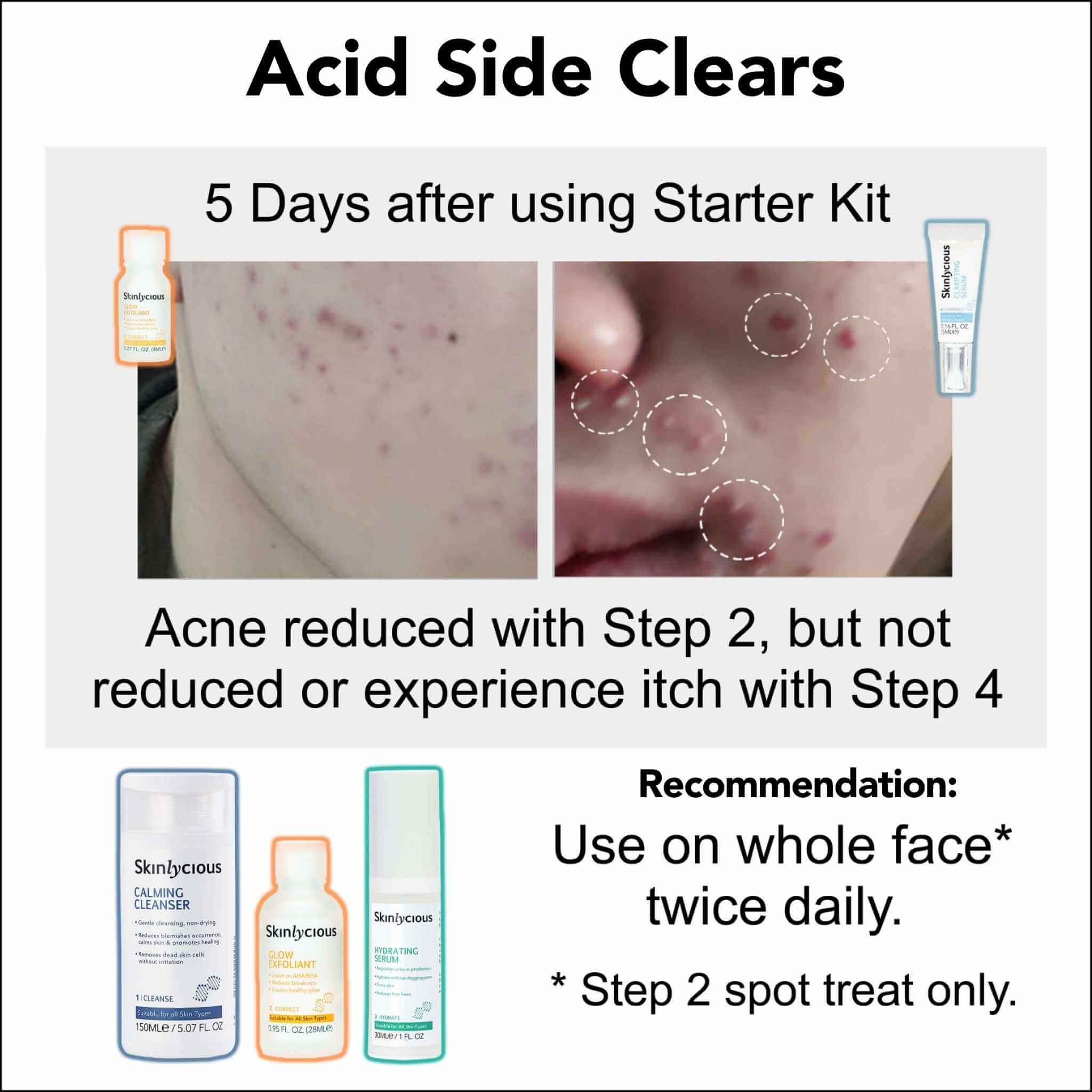 2 Proven Paths to Clear Skin 05