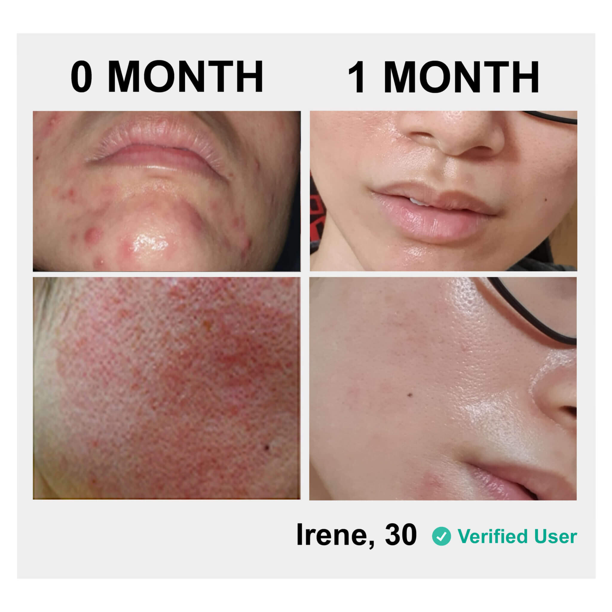 2 Proven Paths to Clear Skin 10