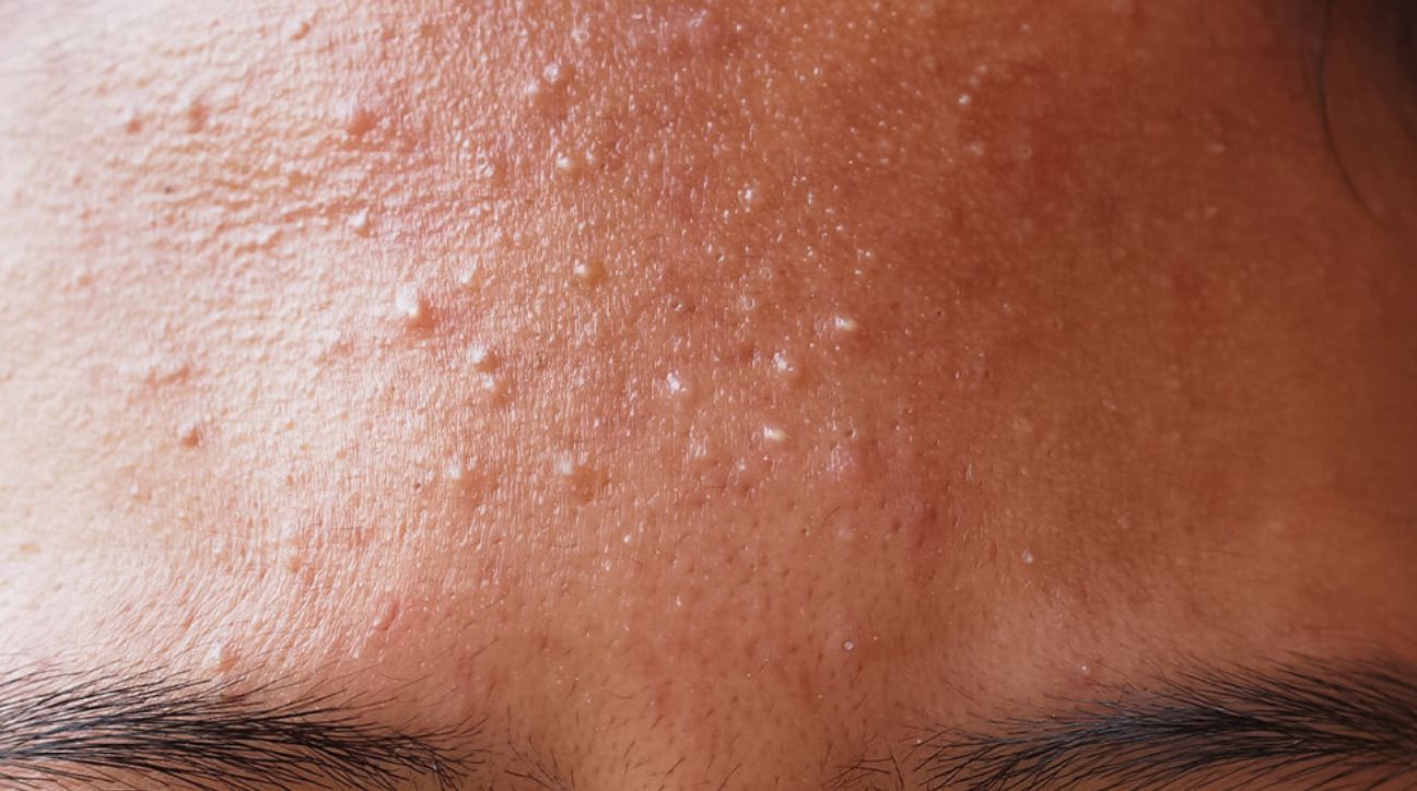 4 skincare-tips for mums new 05