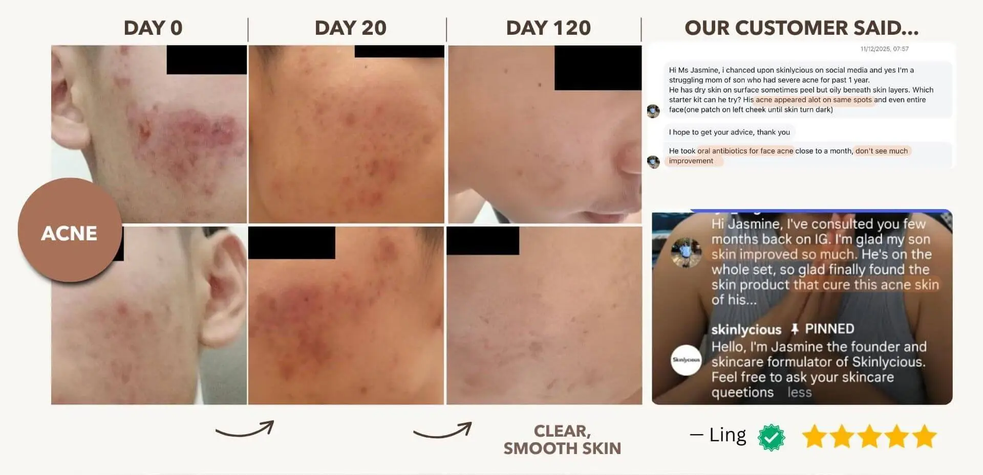Addresses Problem Skin at the Root — So Skin Stays Clear, Smooth, and Glowing