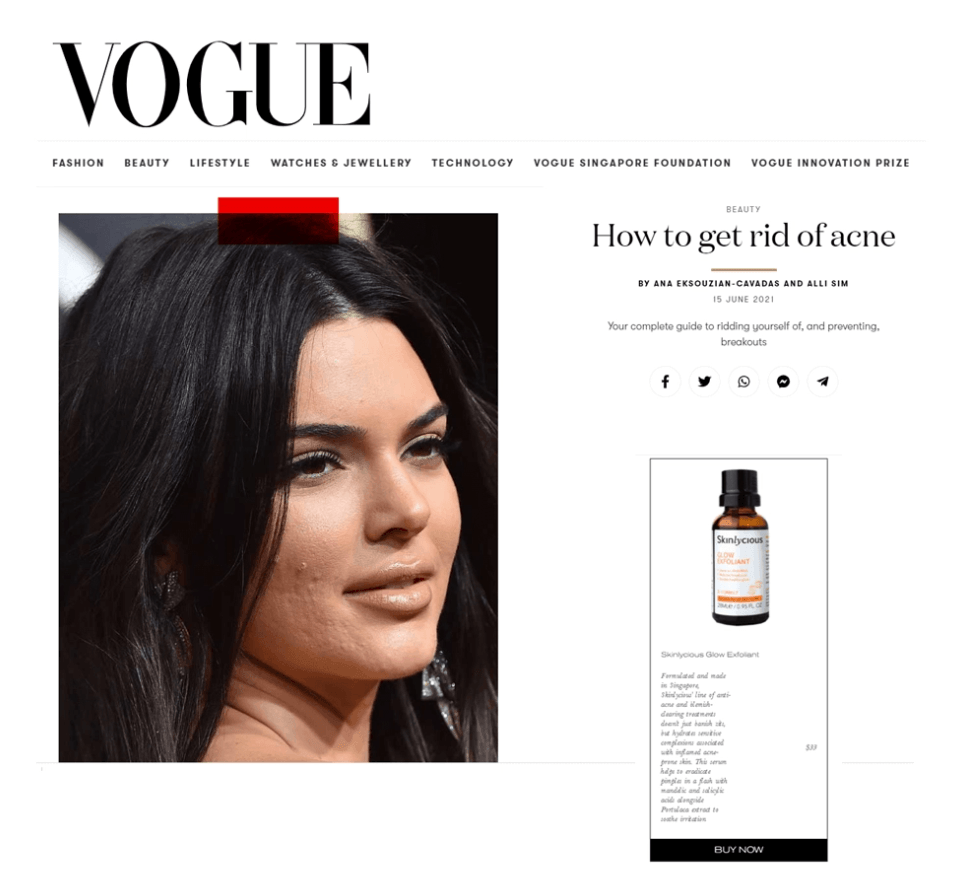 Vogue featured