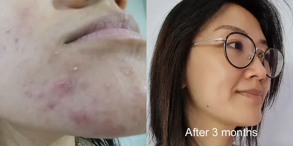 Skinlycious result 03