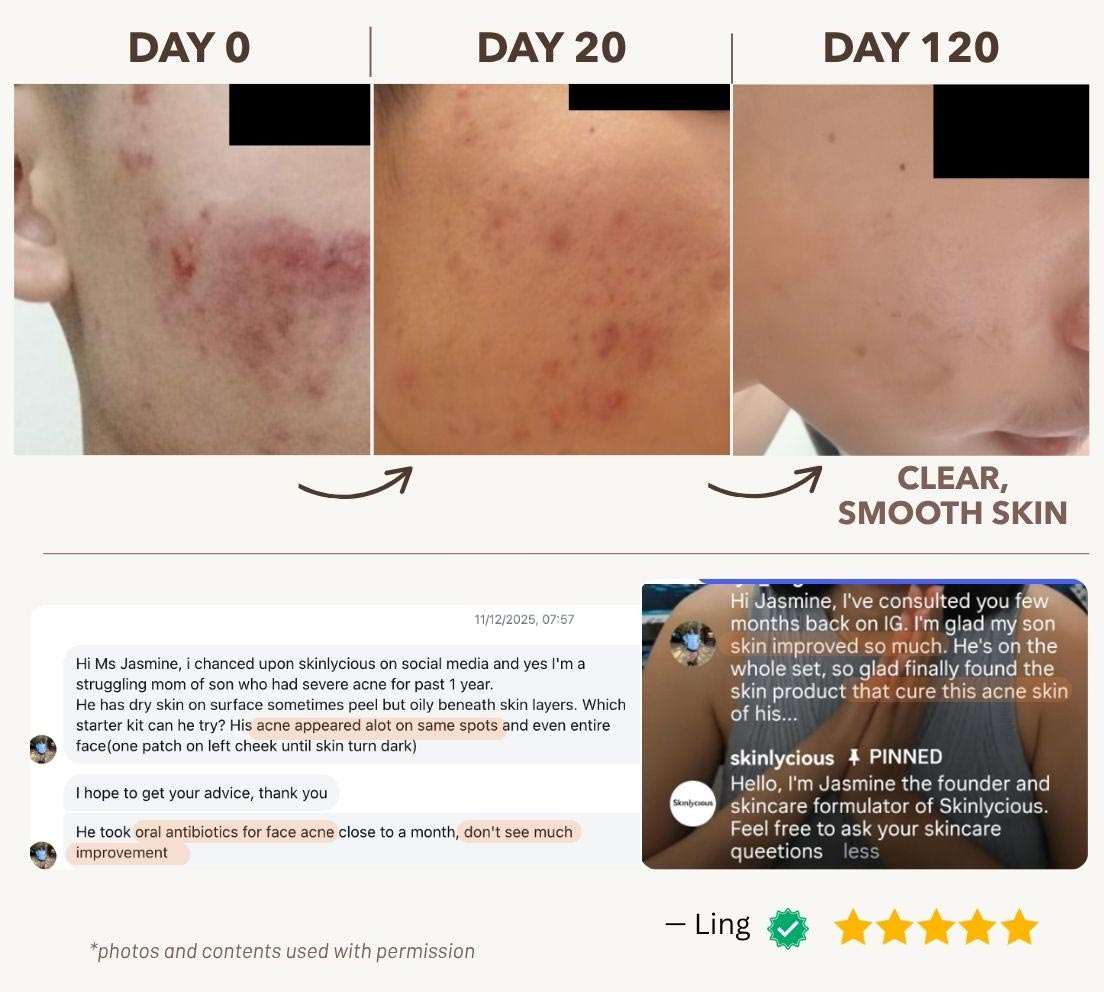 review 04