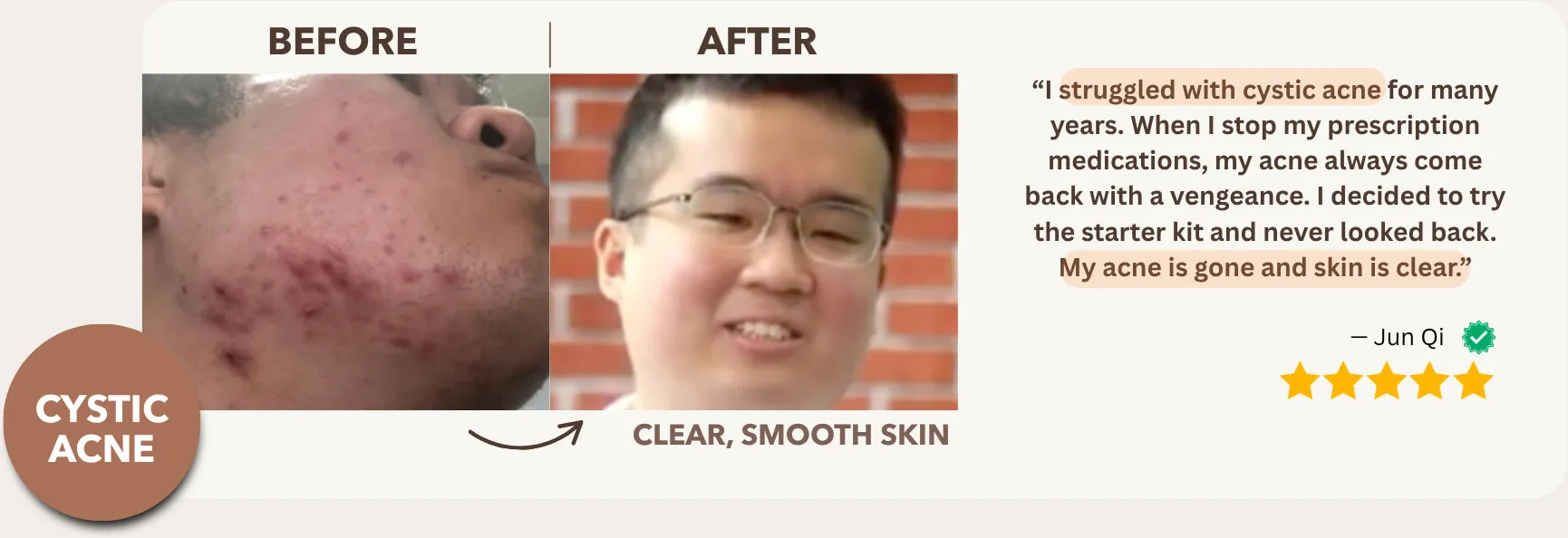 Built From Two Real Personal Stories — Tested on Real Skin