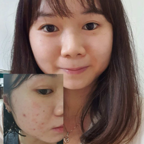 The sensitive breakout