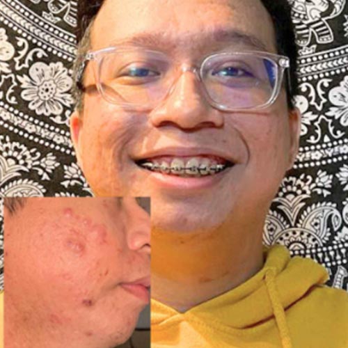 The teenager who keeps breaking out