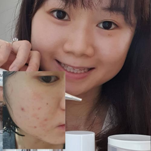 The sensitive breakout